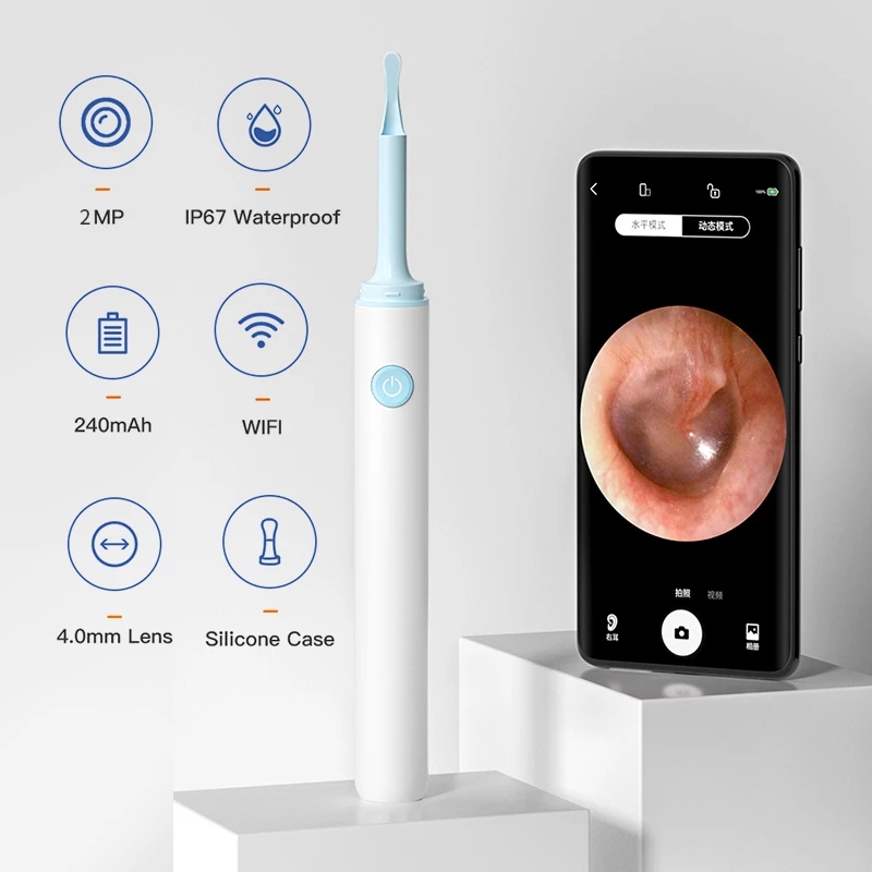 Lighting Visual - Endoskopi telinga Wifi Visual nirkabel 4.0mm,
