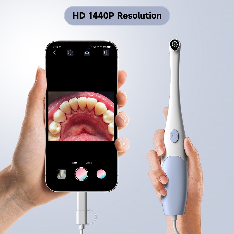 Kamera Endoskop Oral 1440P Fot - Lighting Visual ulasan dan harga
