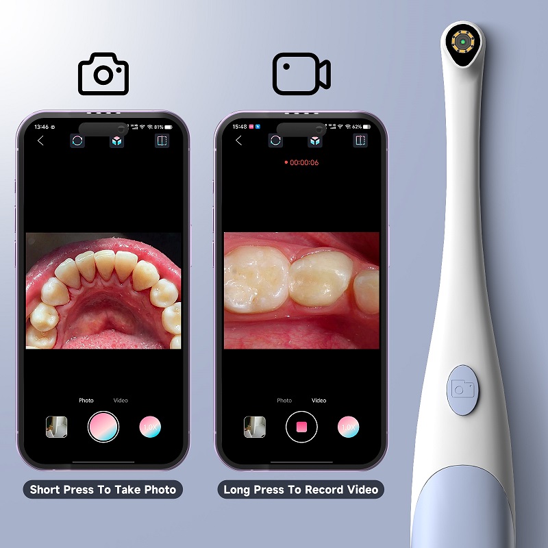 Kamera Endoskop Oral 1440P Fot - Lighting Visual ulasan dan harga